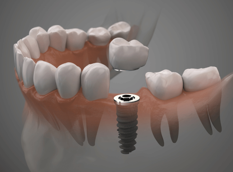 Bond Dental London