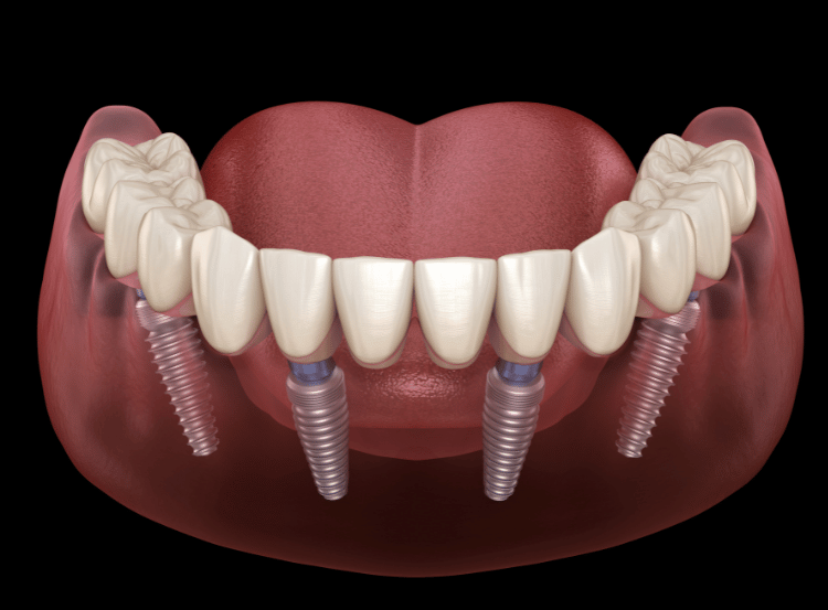 Bond Dental London