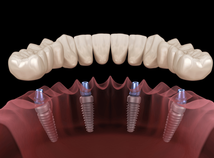 Bond Dental London