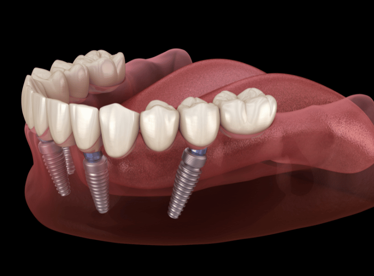 Bond Dental London