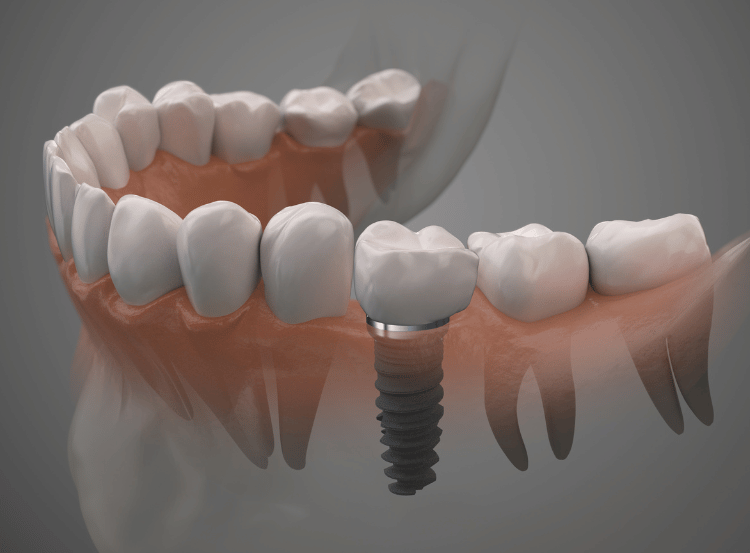 Bond Dental London