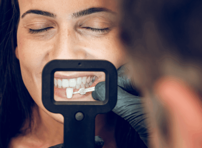 Bond Dental London