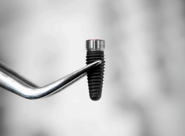 Bond Dental London