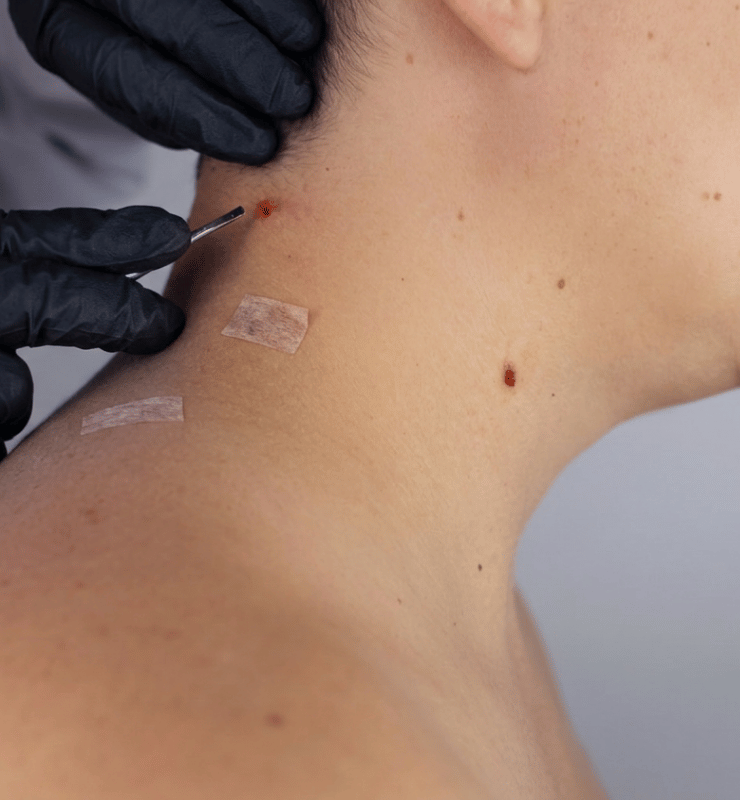 Treatment -  Bond Medical